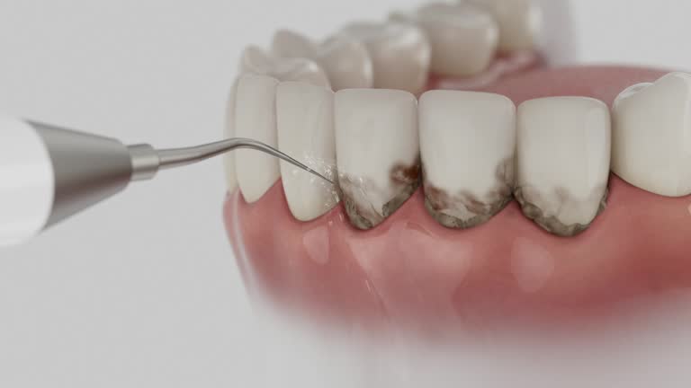 Reliable Teeth Cleaning And Checkup contractor in Granville County County, NC by Dentist Open Now